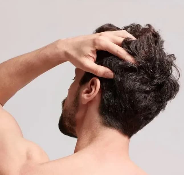 Mesoterapia Capilar: el tratamiento clave para darle vida a tu cabello