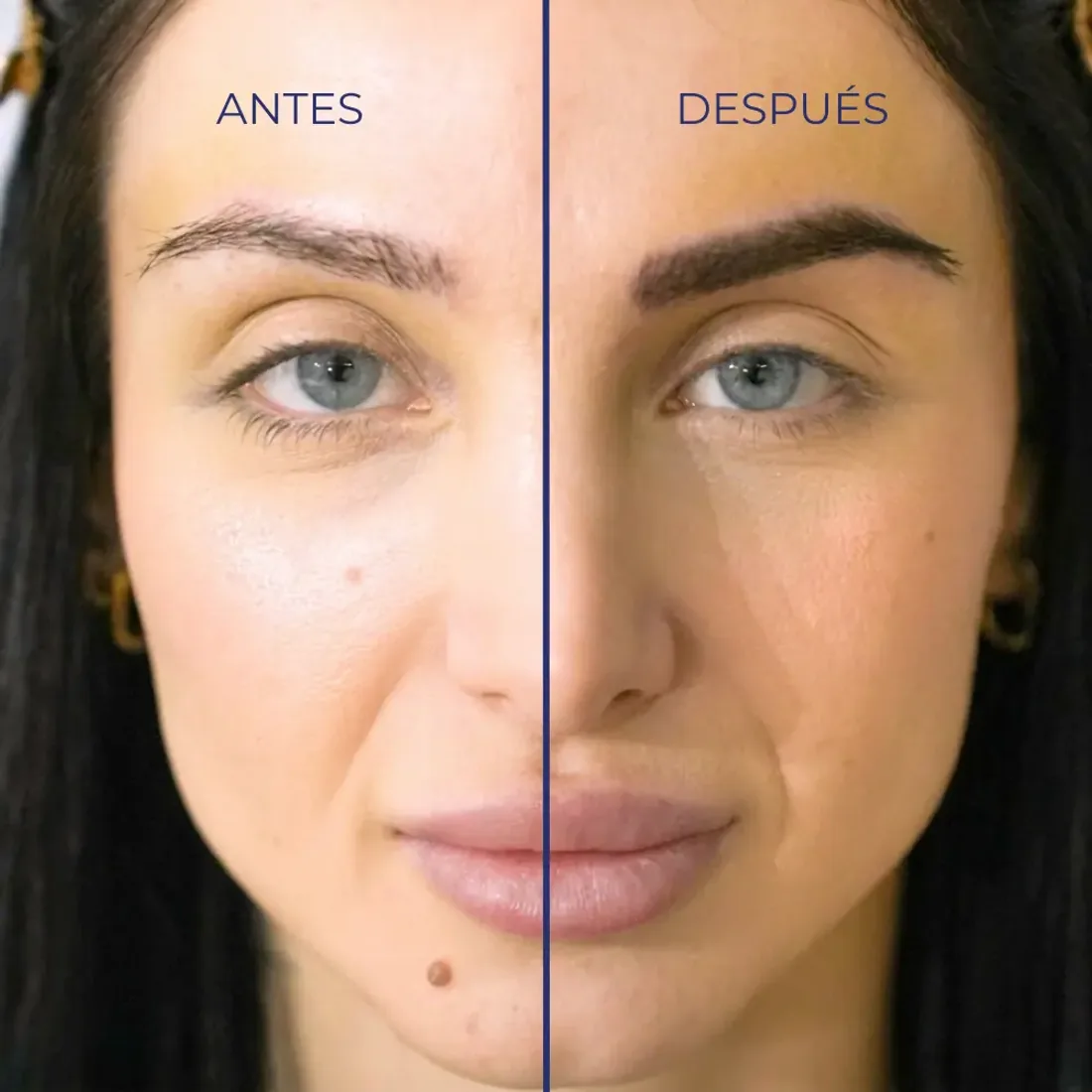 Cejas antes y después