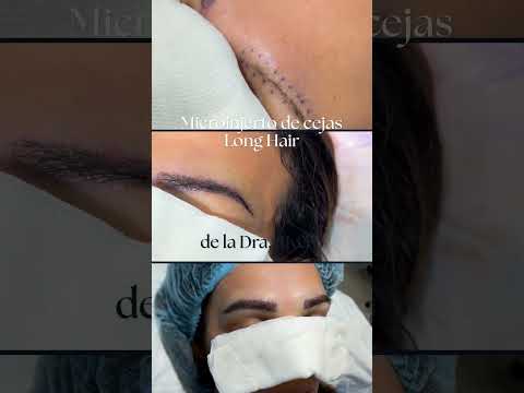 Long Hair · el procedimiento