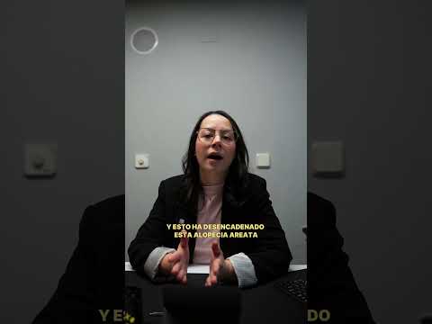 Alopecia areata en mujer · caso real