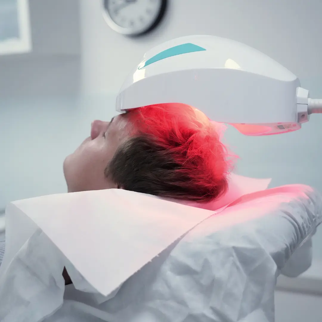Casco láser capilar: tecnología avanzada para estimular el crecimiento del cabello