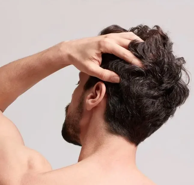 En este momento estás viendo Mesoterapia Capilar: el tratamiento clave para darle vida a tu cabello