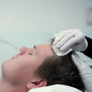 Lee más sobre el artículo PRP capilar: la terapia regenerativa para frenar la caída del cabello