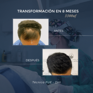 desc (2)